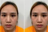 Nguyễn Thị Diễm Thúy SN 2005 đã ra đầu thú