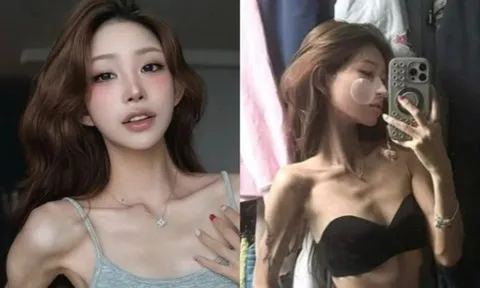 Tình trạng lo ngại của con gái Choi Jin Sil: Từ 100kg chỉ còn da bọc xương