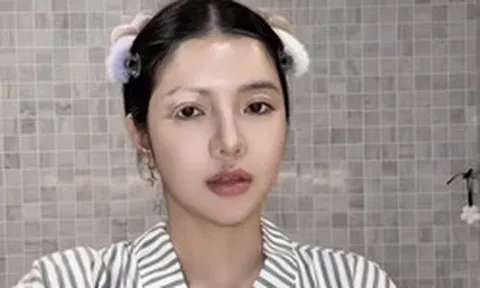 Mỹ nhân Việt mắc bệnh hiếm chỉ 2% dân số thế giới gặp phải