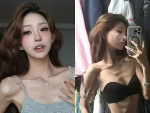 Tình trạng lo ngại của con gái Choi Jin Sil: Từ 100kg chỉ còn da bọc xương