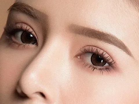 Cắt mí 5 ngày không nhắm được mắt, bác sĩ cảnh báo nguy cơ