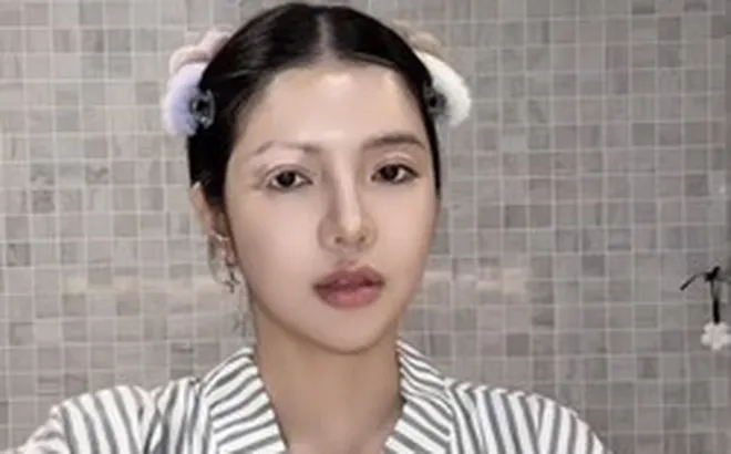 Mỹ nhân Việt mắc bệnh hiếm chỉ 2% dân số thế giới gặp phải